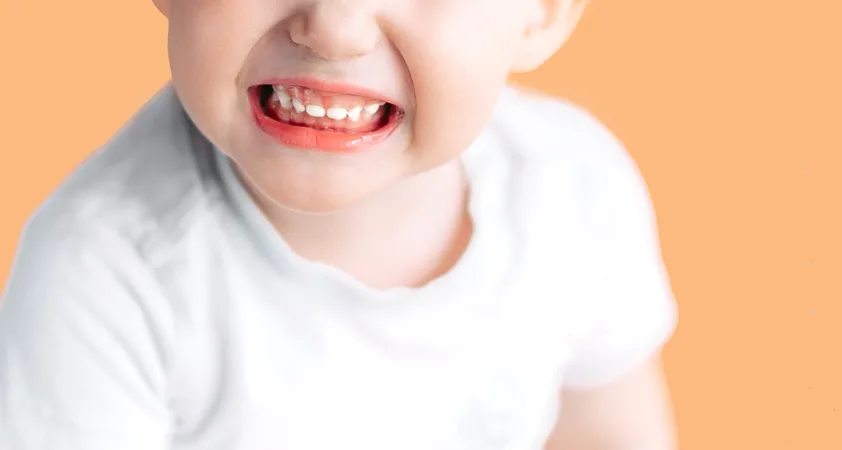 Škrtanje z zobmi pri otrocih: Zakaj pride do škrtanja in kako ga lahko omilimo - Modna.si